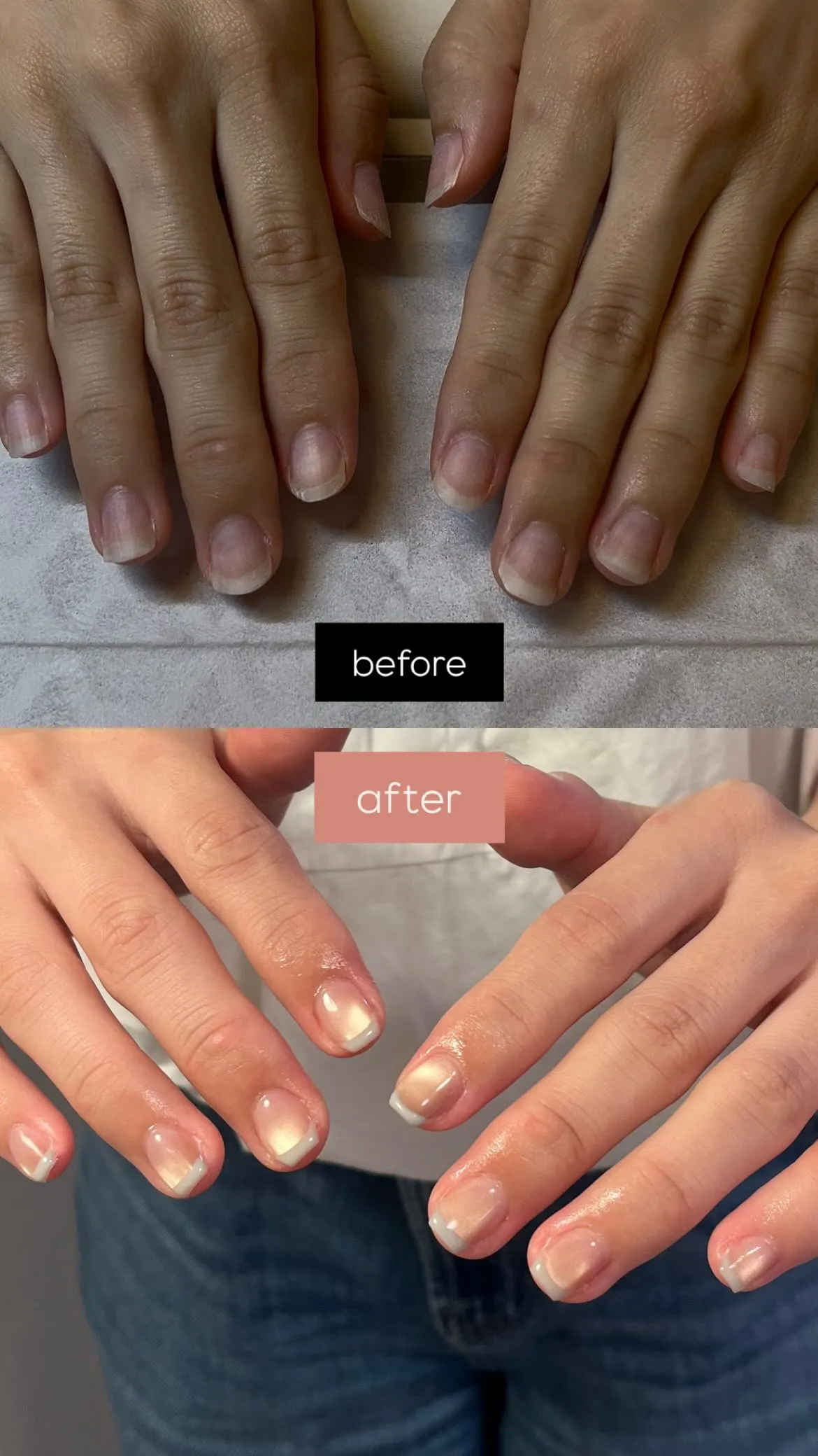 before▶︎after✨